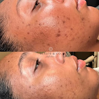 Beauté & Co. Aesthetics LLC - Photo 6 - Car repair in Panama City, FL, Panama City