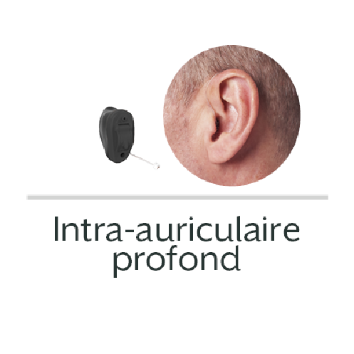 Magasin d'appareils auditifs Bien Entendre - Appareils Auditifs - Saint-Avold Saint-Avold