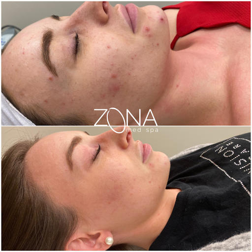 Skin Care Clinic «ZONA MED SPA», reviews and photos, 9767 N 91st St #102, Scottsdale, AZ 85258, USA