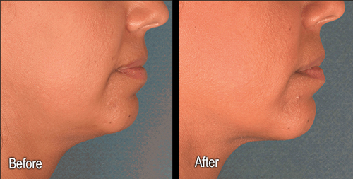 Explore metaphysical tattoo ideas, creative tattoo ideas in Sterling Heights, available at Skin & Vein Center