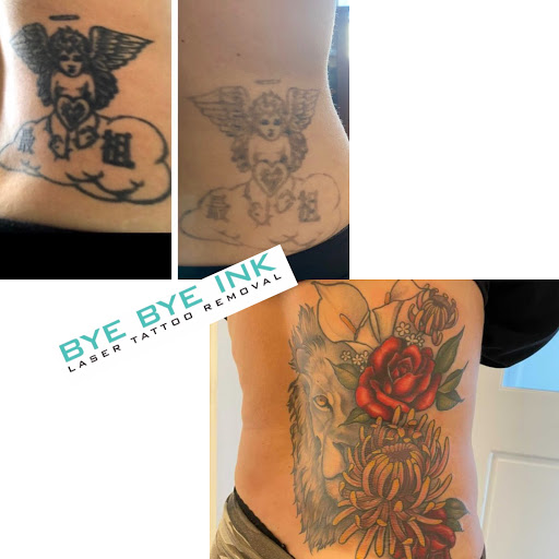 Explore female full back tattoo ideas, creative tattoo ideas in Middle Village, available at Bye Bye Ink Laser Tattoo Removal