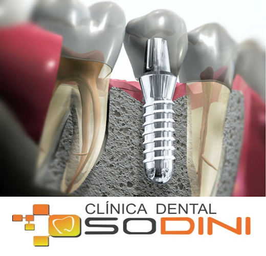 Opiniones de Clinica Dental SODINI en Cerro Colorado - Dentista