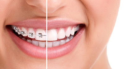Docteur BERR Hélène Orthodontiste à Saint-Dié-des-Vosges