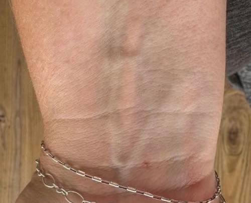 Explore stitch and angel tattoo ideas, creative tattoo ideas in Springfield, available at Under My Skin Tattoo Removal