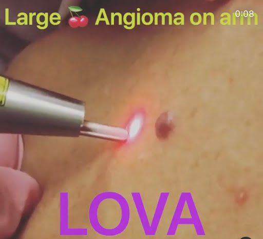 Find tornado tattoo ideas for your next unique tattoo in Lake Oswego at Lake Oswego Vein and Aesthetic LOVA