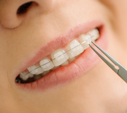 Dr. Norsen | Bolton Orthodontics, Invisalign, Braces