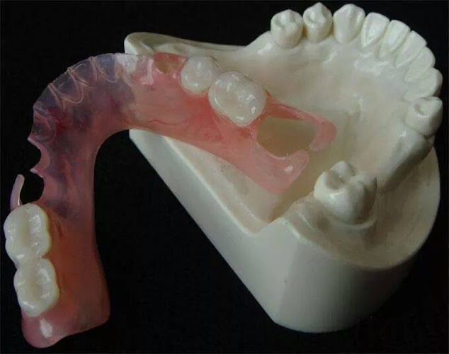 Comentarios y opiniones de Reparación de prótesis dental a domicilio