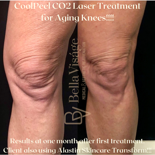 Explore tattoo ideas on ribs for guys, creative tattoo ideas in Lakeland, available at Bella Visge Medical & Aesthetic Rejuvenation