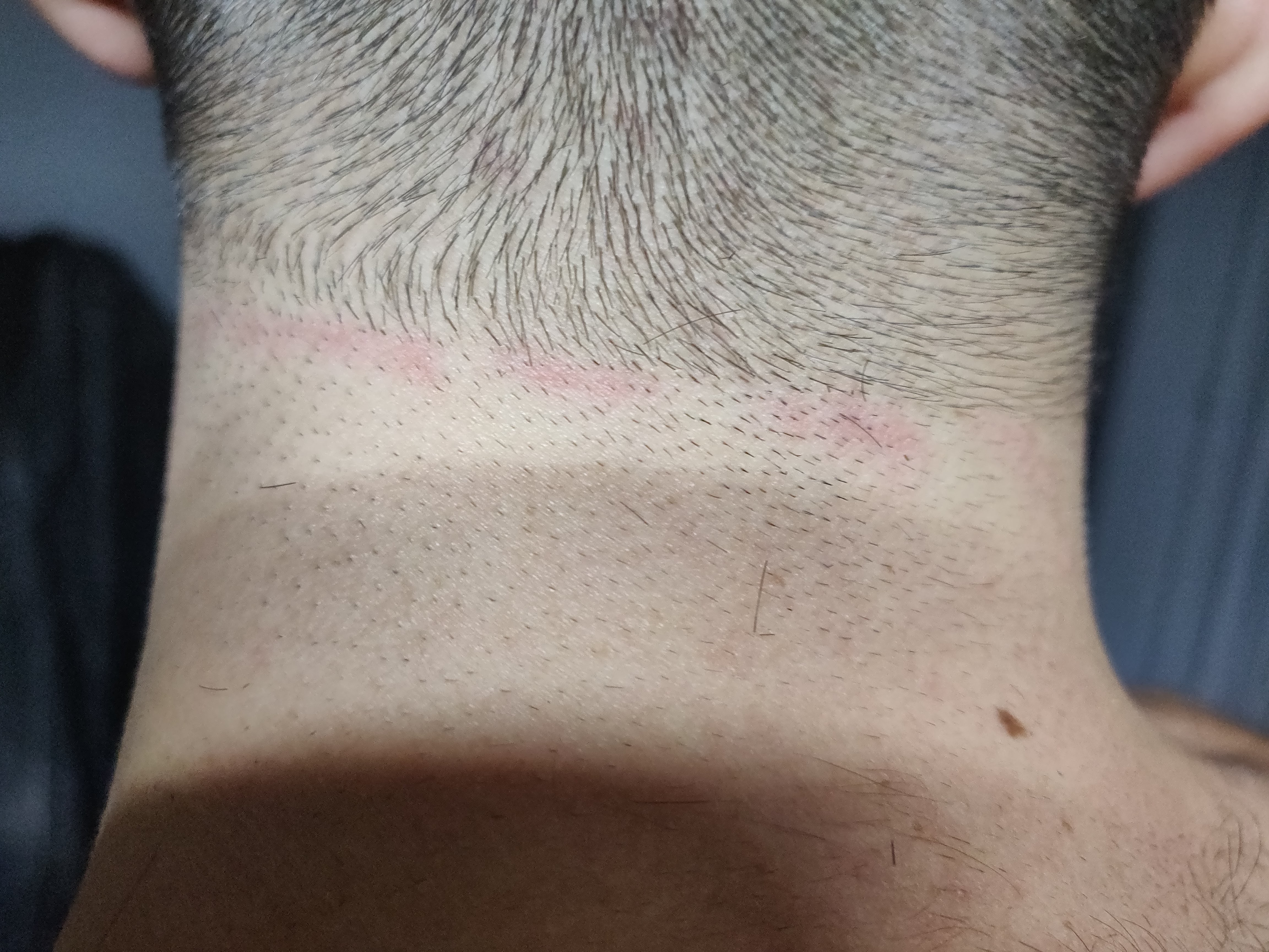 Photo n° 1 de l'avis de Philippe.O fait le 08/10/2021 à 17:47