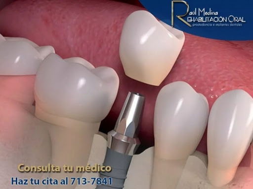 Dr. Raúl Uriel Medina Martinez, Dentista - Odontólogo