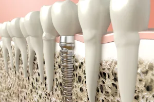 Clínica dental Vall Hebrón image