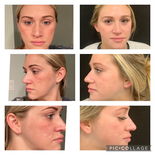 Explore cute female tattoos ideas, creative tattoo ideas in Lake Dallas, available at Restore YOUth Med Spa