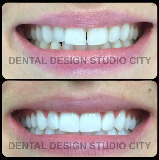 Dental Design Studio City image
