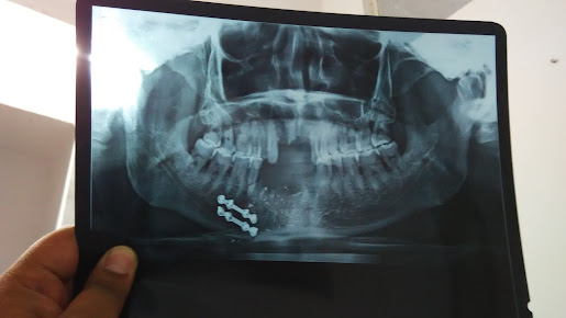 Cosmodent Multispeciality Dental Clinic - Cosmodent Multispeciality Dental Clinic