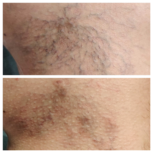 Explore hard work tattoo ideas, creative tattoo ideas in Mesa, available at AZ Laser Studio & Medspa