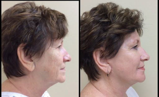 Explore tattoo date ideas, creative tattoo ideas in Sterling Heights, available at Skin & Vein Center