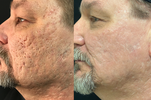 Explore flash sheets tattoo ideas, creative tattoo ideas in Brookfield, available at Milwaukee Laser & Body Aesthetics