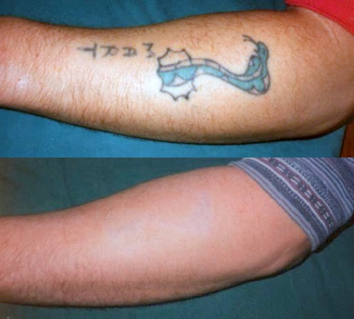 Explore locket tattoo ideas, creative tattoo ideas in Bethlehem, available at New Wave Laser Tattoo Removal