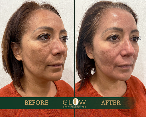 Glow Aesthetic Center Encino image