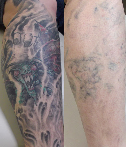 Explore sacred geometry tattoo ideas, creative tattoo ideas in Weatherford, available at Vanish Laser Tattoo Removal and Skin Aesthetics