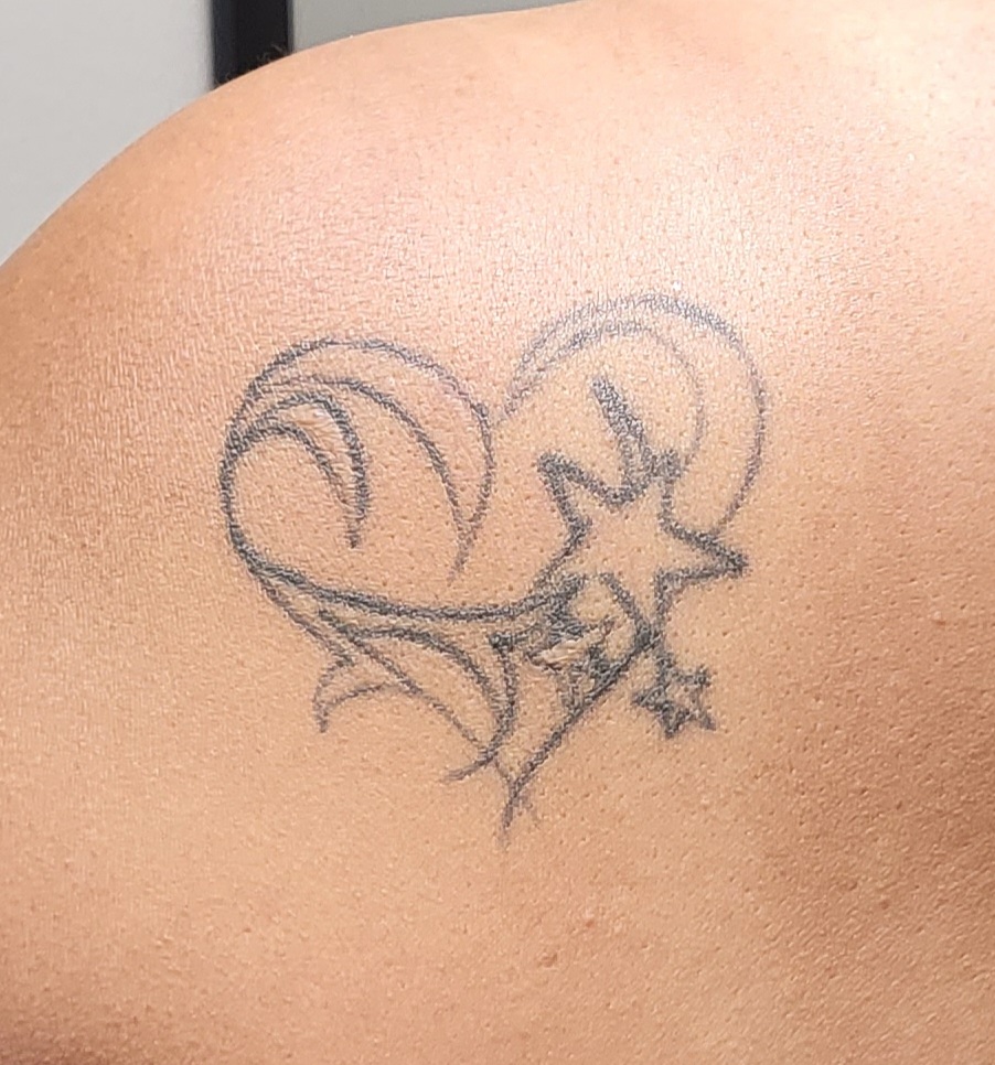 Phenix Anaheim Towne Center 92805