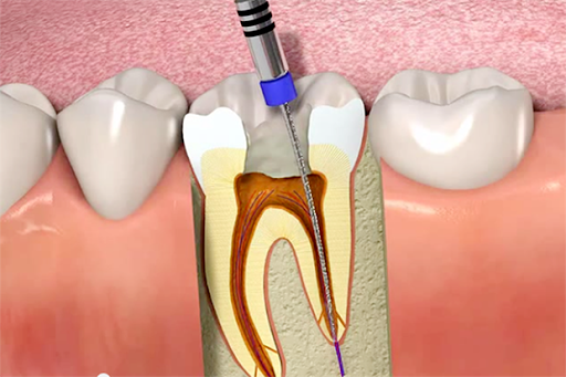 Thantakit International Dental Center in Bangkok, Thailand