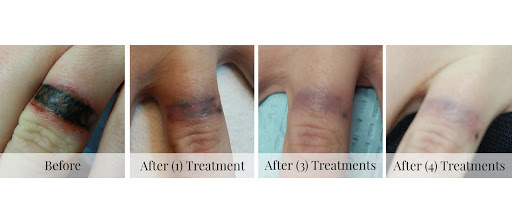 Explore celtic tattoo ideas for men, creative tattoo ideas in Adrian, available at TatFreeMD Tattoo Removal Specialists