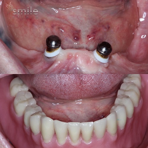 Smile Cliniq - Finchley Dentist - London