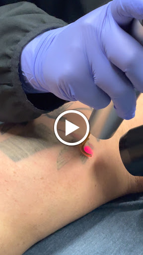 Explore fern tattoo ideas, creative tattoo ideas in El Paso, available at Removery Tattoo Removal & Fading