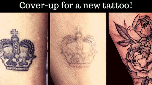 Explore metamorphosis tattoo ideas, creative tattoo ideas in Covington, available at Northshore Tattoo Removal