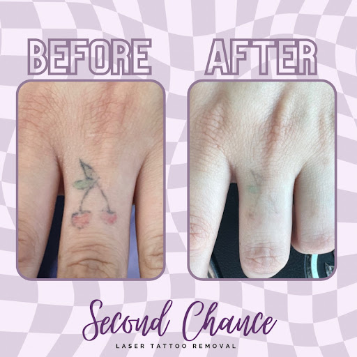 Explore meaningful unique tattoo ideas, creative tattoo ideas in Lake Jackson, available at Second Chance Laser Tattoo Removal