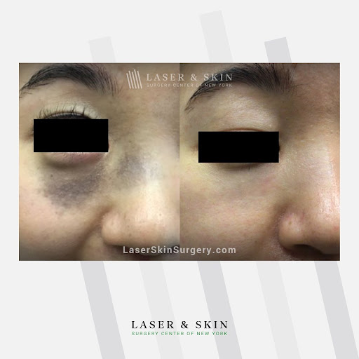 Explore behind ear tattoo ideas, creative tattoo ideas in Southampton, available at Laser & Skin Surgery Center of New York - Southampton