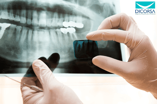 Radiología dental Santiago de Querétaro