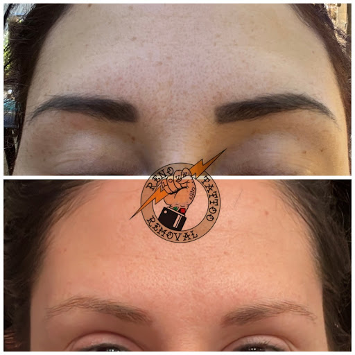 Explore solid tattoo ideas, creative tattoo ideas in Reno, available at Reno Tattoo Removal