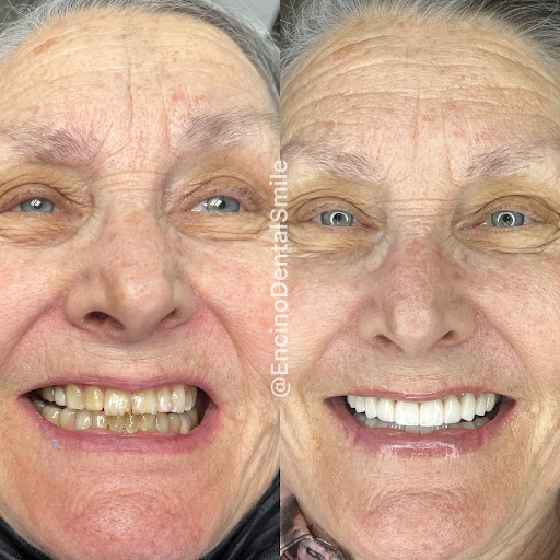 Encino Dental Smile image