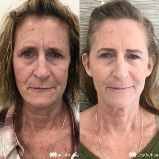 Explore half sleeve flower tattoo ideas, creative tattoo ideas in Pleasant Grove, available at Aesthetica