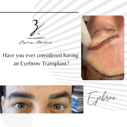 Ziering Medical Hair Restoration Beverly Hills image