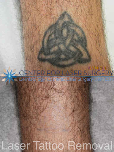 Explore travel tattoos ideas, creative tattoo ideas in Washington, available at Center For Laser Surgery