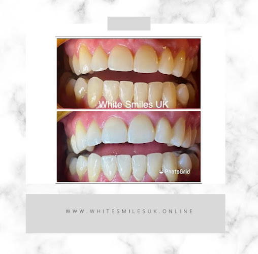 Comments and reviews of White Smiles UK