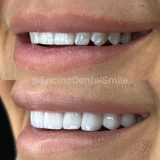Encino Dental Smile image