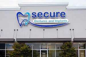 Secure Dentures & Implants image