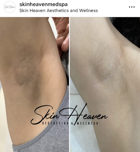 Skin Heaven Aesthetics and Wellness image
