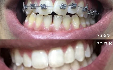 ד׳׳ר מועאד חאסקיה - רופא שיניים בכפר סבא - כל טיפולי השיניים במקום אחד! image