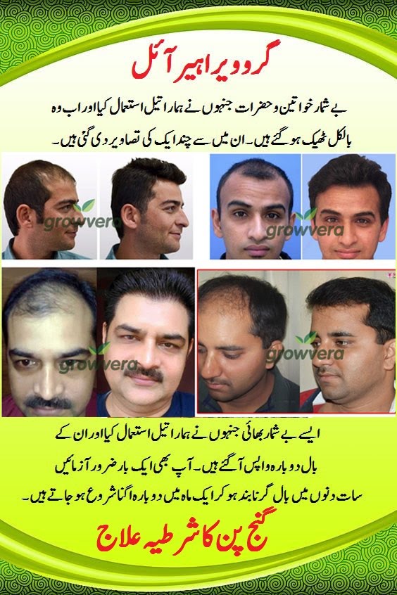 Best Hair Growth oil in Pakistan