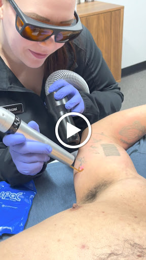 Explore tinkerbell tattoo ideas, creative tattoo ideas in El Paso, available at Removery Tattoo Removal & Fading