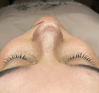 On The Glow Skincare Studio - Photo 5 - Car repair in New Haven, CT, New Haven