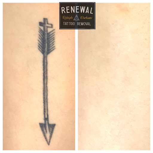 Find family meaning tattoo ideas for your next unique tattoo in Raleigh at Renewal Tattoo Removal