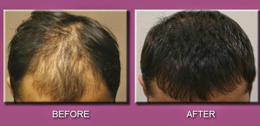 ديرما نوتنغهام - Your Derma Nottingham
