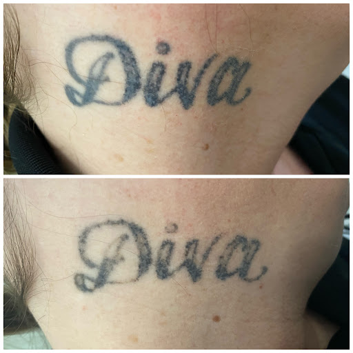 Explore cartoon tattoo ideas, creative tattoo ideas in Lake Jackson, available at Second Chance Laser Tattoo Removal