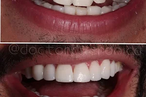 Doctora Veronica Diseño de Sonrisa en Bogotá Carillas de Porcelana Implantes Dentales Ortodoncia Invisalign image